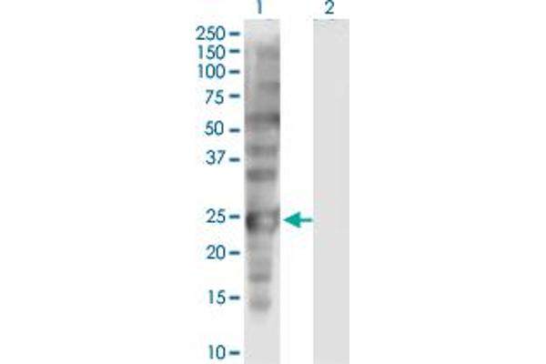 SSX1 antibody  (AA 89-188)