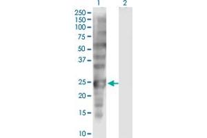 Western Blot analysis of SSX1 expression in transfected 293T cell line by SSX1 monoclonal antibody (M01), clone 5B2. (SSX1 antibody  (AA 89-188))