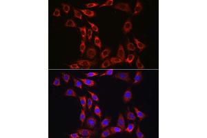 Immunofluorescence analysis of NIH/3T3 cells using IL15RA Rabbit pAb (ABIN3017117, ABIN1680439 and ABIN7101500) at dilution of 1:100 (40x lens). (IL15RA antibody  (AA 31-205))