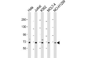 Western Blot at 1:2000 dilution Lane 1: Hela whole cell lysate Lane 2: Jurkat whole cell lysate Lane 3: K562 whole cell lysate Lane 4: MOLT-4 whole cell lysate Lane 5: NCI-H1299 whole cell lysate Lysates/proteins at 20 ug per lane.