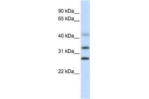 CENPH antibody used at 1 ug/ml to detect target protein.