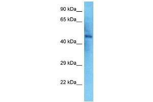 Host:  Rabbit  Target Name:  NEK2  Sample Type:  Thyroid Tumor lysates  Antibody Dilution:  1. (NEK2 antibody  (N-Term))