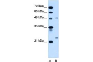 Western Blotting (WB) image for anti-Sphingomyelin phosphodiesterase 2, Neutral Membrane (Neutral Sphingomyelinase) (SMPD2) antibody (ABIN2462850) (SMPD2 antibody)