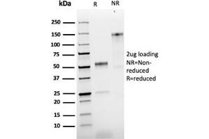 SDS-PAGE Analysis Purified NGFR Rabbit Recombinant Monoclonal Antibody (NGFR/1997R).