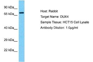 Host: Rabbit Target Name: DUX1 Sample Tissue: Human HCT15 Whole Cell  Antibody Dilution: 1ug/ml