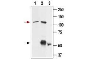 Immunoprecipitation of rat basophilic leukemia (RBL) cell lysate: - 1. (TRPV2 antibody  (1st Extracellular Loop))