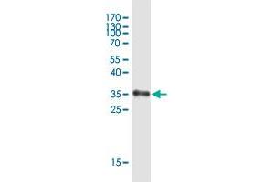 Western Blot detection against Immunogen (35 KDa) . (SPINK6 antibody  (AA 1-80))