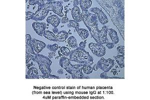 Image no. 1 for anti-Hypoxia Inducible Factor 1, alpha Subunit (Basic Helix-Loop-Helix Transcription Factor) (HIF1A) (AA 329-530) antibody (ABIN363210) (HIF1A antibody  (AA 329-530))