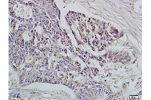 Immunohistochemistry (IHC) image for anti-HLA Class I Histocompatibility Antigen, alpha Chain E (HLA-E) (AA 251-358) antibody (ABIN674334) (HLA-E antibody  (AA 251-358))