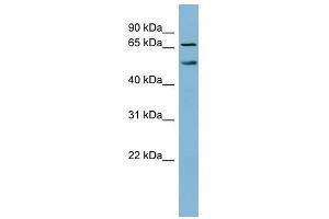 MYST1 antibody used at 1 ug/ml to detect target protein. (MYST1 antibody  (N-Term))