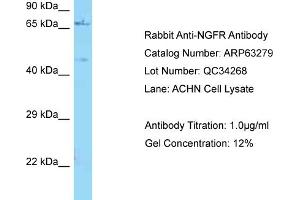Western Blotting (WB) image for anti-Nerve Growth Factor Receptor (NGFR) (C-Term) antibody (ABIN2789433) (NGFR antibody  (C-Term))