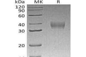 Leukocyte Immunoglobulin-Like Receptor, Subfamily B (With TM and ITIM Domains), Member 4 (LILRB4) protein (His tag)