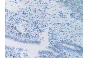 IHC-P analysis of Mouse Uterus Tissue, with DAB staining. (ATF6 antibody  (AA 1-377))