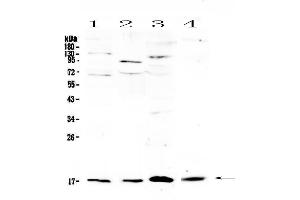 Western blot analysis of IL1F10 using anti-IL1F10 antibody .
