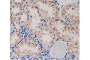 Used in DAB staining on fromalin fixed paraffin- embedded Kidney tissue (CARD9 antibody  (AA 26-283))