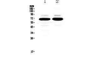 Western blot analysis of splicing factor 1 using anti-splicing factor 1 antibody . (Splicing Factor 1 antibody  (AA 160-266))