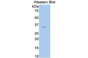 WB of Protein Standard: different control antibodies against Highly purified E. (ANGPTL4 ELISA Kit)