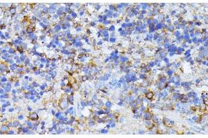 Immunohistochemistry (Paraffin-embedded Sections) (IHC (p)) image for anti-Carbamoyl-Phosphate Synthetase 2, Aspartate Transcarbamylase, and Dihydroorotase (CAD) antibody (ABIN7264367)