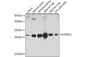 Western blot analysis of extracts of various cell lines, using CD99L2 antibody (ABIN7266229) at 1:1000 dilution. (CD99L2 antibody  (AA 26-185))