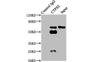 Immunoprecipitating CTPS2 in HepG2 whole cell lysate Lane 1: Rabbit control IgG instead of ABIN7148718 in HepG2 whole cell lysate. (CTPS2 antibody  (AA 62-315))