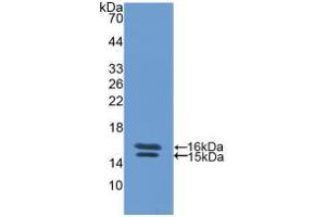 Western blot analysis of recombinant Human VIP. (Vip antibody  (AA 29-165))