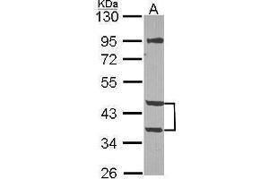 WB Image Sample (30 ug of whole cell lysate) A: NT2D1 10% SDS PAGE antibody diluted at 1:1000 (MPI antibody)