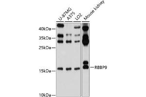 Western blot analysis of extracts of various cell lines, using RBBP9 antibody (ABIN6129095, ABIN6146752, ABIN6146753 and ABIN6220638) at 1:1000 dilution. (RBBP9 antibody  (AA 1-186))