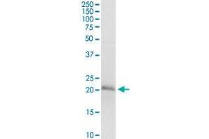 D4S234E monoclonal antibody (M01), clone 1C3. (NSG1 antibody  (AA 1-185))