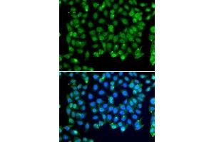 Immunofluorescence analysis of MCF-7 cells using RNF8 antibody. (RNF8 antibody)