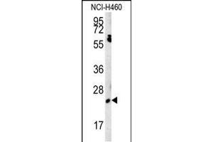 Western blot analysis in NCI-H460 cell line lysates (15ug/lane).