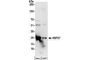 Western Blotting (WB) image for anti-Heat Shock 27kDa Protein 1 (HSPB1) (AA 150-200) antibody (ABIN7453910)