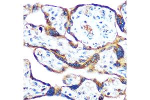 Immunohistochemistry of paraffin-embedded human placenta using GDF15 Rabbit pAb (ABIN3020658, ABIN3020659, ABIN3020660, ABIN1512942 and ABIN6213652) at dilution of 1:100 (40x lens).