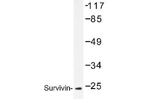 Image no. 1 for anti-Baculoviral IAP Repeat-Containing 5 (BIRC5) antibody (ABIN272115) (Survivin antibody)