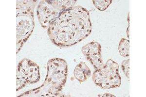 Immunohistochemistry of paraffin-embedded Human placenta using Phospho-PRKAA1(T183)/PRKAA2(T172) Polyclonal Antibody at dilution of 1:100 (40x lens). (PRKAA1 antibody  (pThr172, pThr183))