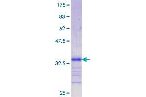 Image no. 1 for Low Density Lipoprotein Receptor-Related Protein 5 (LRP5) (AA 41-130) protein (GST tag) (ABIN1309738) (LRP5 Protein (AA 41-130) (GST tag))