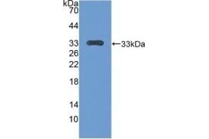 Detection of Recombinant CENPH, Mouse using Polyclonal Antibody to Centromere Protein H (CENPH) (CENPH antibody  (AA 28-241))