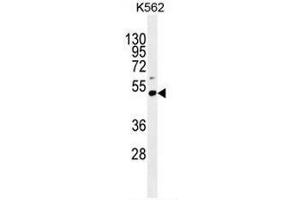 PRAMEF10 Antibody (C-term) western blot analysis in K562 cell line lysates (35µg/lane). (PRAMEF10 antibody  (C-Term))