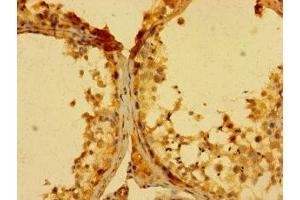Immunohistochemistry of paraffin-embedded human testis tissue using ABIN7153835 at dilution of 1:100 (GCET2 antibody  (AA 1-178))