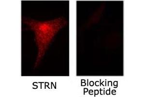 Immunofluorescence staining of STRN on NIH/3T3 cells with or without blocking peptide with STRN polyclonal antibody .