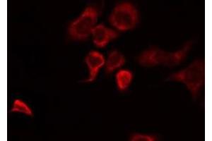 ABIN6274952 staining HuvEc by IF/ICC. (CHST10 antibody  (Internal Region))