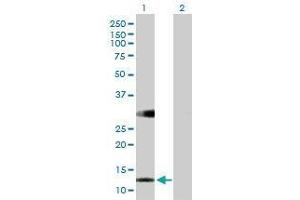 Lane 1: RBP5 transfected lysate ( 14. (RBP5 293T Cell Transient Overexpression Lysate(Denatured))