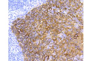 Paraformaldehyde-fixed, paraffin embedded human tonsil, Antigen retrieval by boiling in sodium citrate buffer (pH6) for 15min, Block endogenous peroxidase by 3% hydrogen peroxide for 30 minutes, Blocking buffer at 37°C for 20min, Antibody incubation with Cytokeratin 5 (2H5) Monoclonal Antibody  at 1:50 overnight at 4°C, followed by a conjugated secondary and DAB staining. (Cytokeratin 5 antibody)