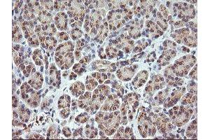 Image no. 2 for anti-Retinoic Acid Receptor Responder (Tazarotene Induced) 1 (RARRES1) antibody (ABIN1500600) (RARRES1 antibody)