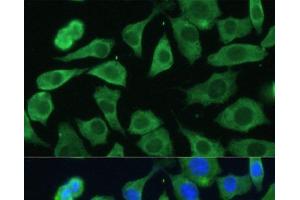 Immunofluorescence (IF) image for anti-Eukaryotic Translation Initiation Factor 3, Subunit D (EIF3D) antibody (ABIN7261884)