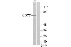 Western blot analysis of extracts from Jurkat cells, using CDC7 antibody. (CDC7 antibody  (Internal Region))