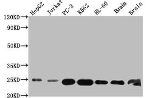 Western Blot Positive WB detected in: HepG2 whole cell lysate, Jurkat whole cell lysate, PC-3 whole cell lysate, K562 whole cell lysate, HL-60 whole cell lysate, Mouse Brain whole cell lysate, Rat Brain whole cell lysate All lanes: GSTP1 antibody at 1:1000 Secondary Goat polyclonal to rabbit IgG at 1/50000 dilution Predicted band size: 24 kDa Observed band size: 24 kDa (Recombinant GSTP1 antibody)