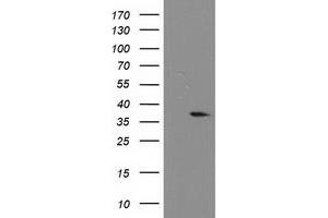 Western Blotting (WB) image for anti-Nucleotide Binding Protein-Like (NUBPL) (AA 1-250) antibody (ABIN1490631)