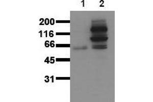 Western Blotting (WB) image for anti-Catenin (Cadherin-Associated Protein), beta 1, 88kDa (CTNNB1) (pTyr654) antibody (ABIN126742) (CTNNB1 antibody  (pTyr654))