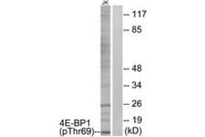 Western blot analysis of extracts from Jurkat cells treated with EGF 200ng/ml 30', using 4E-BP1 (Phospho-Thr69) Antibody. (eIF4EBP1 antibody  (pThr69))