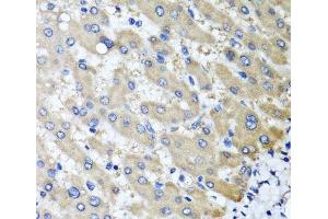 Immunohistochemistry of paraffin-embedded Human liver damage using RBP2 Polyclonal Antibody at dilution of 1:100 (40x lens). (RBP2 antibody)